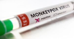 monkeypox kit