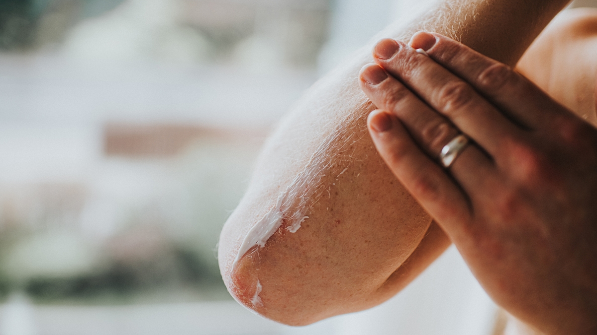 Photo of Dry Skin In Winters: क्या आपकी भी सर्दियों में हो जाती है स्किन ड्राई ?