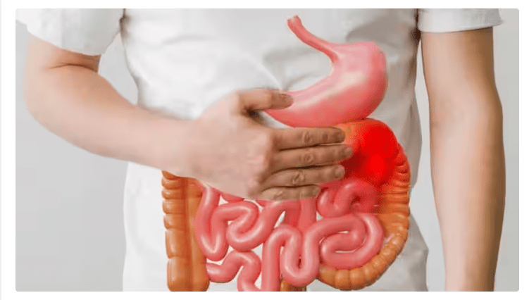 Photo of Stomach flu: दिल्ली में तेजी से फैल रही है पेट की यह खतरनाक बीमारी, जानने के लिए पढ़िए पूरी ख़बर