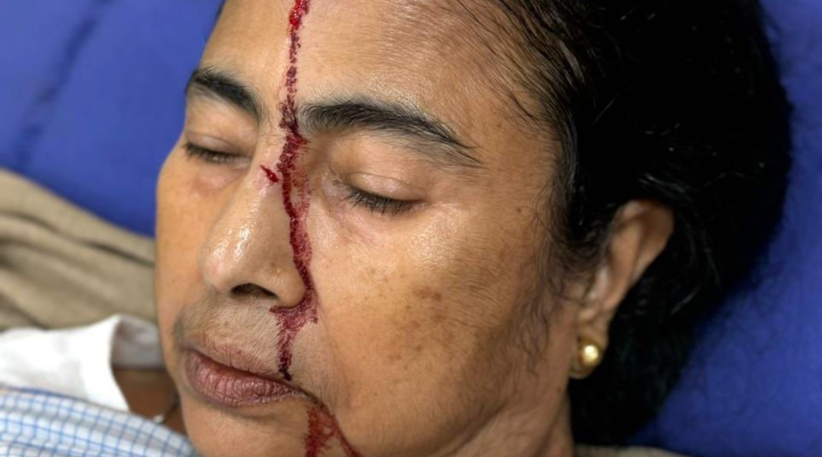 Photo of Bengal News: CM ममता बनर्जी के सर में आई गंभीर चोट, अस्पताल मे भर्ती