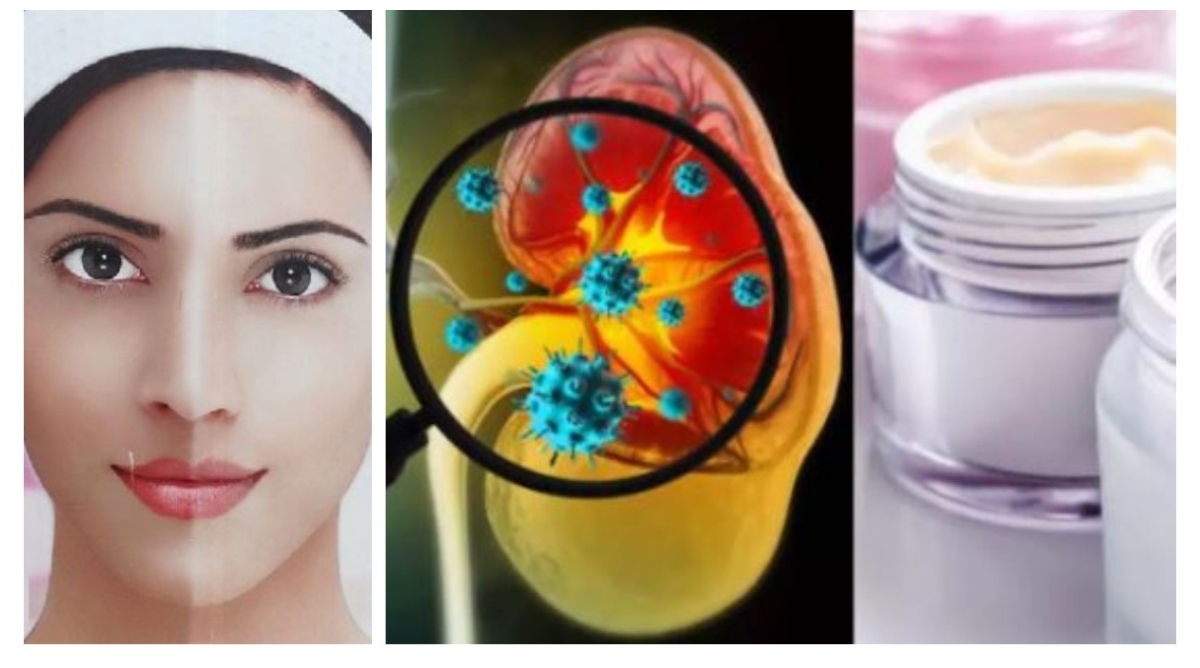 Photo of Disease From Fairness cream: अगर फेयरनेस क्रीम का इस्तेमाल करते हैं तो हो जाएं सावधान,  किडनी पर पड़ सकता है असर!
