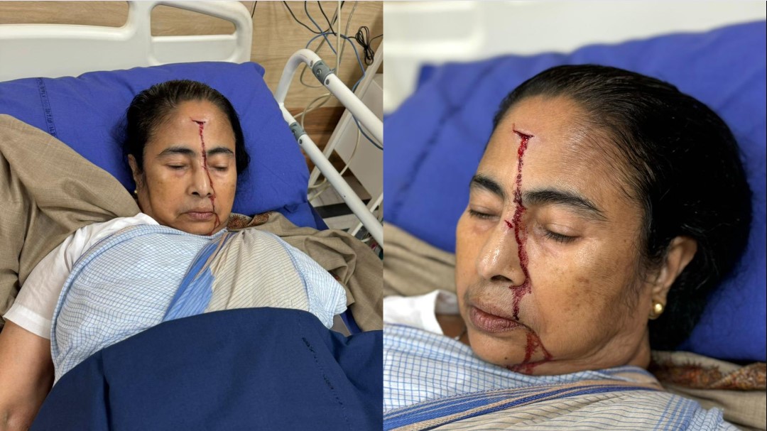 Photo of Mamata Banerjee Injury: ममता बनर्जी को माथे पर लगे तीन टांके, अभी रहेंगी ऑब्जर्वेशन में