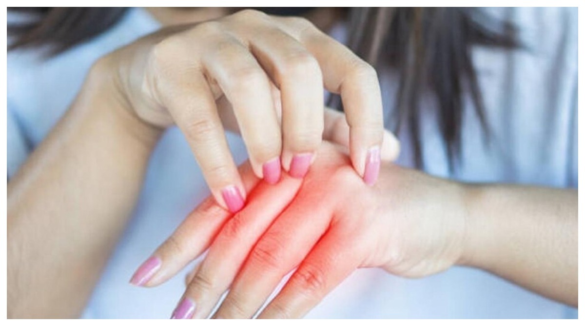Photo of Protein Deficiency Symptom: शरीर में दिख रहे हैं ये लक्षण, न करें नजरअंदाज, हो सकती है प्रोटीन की कमी