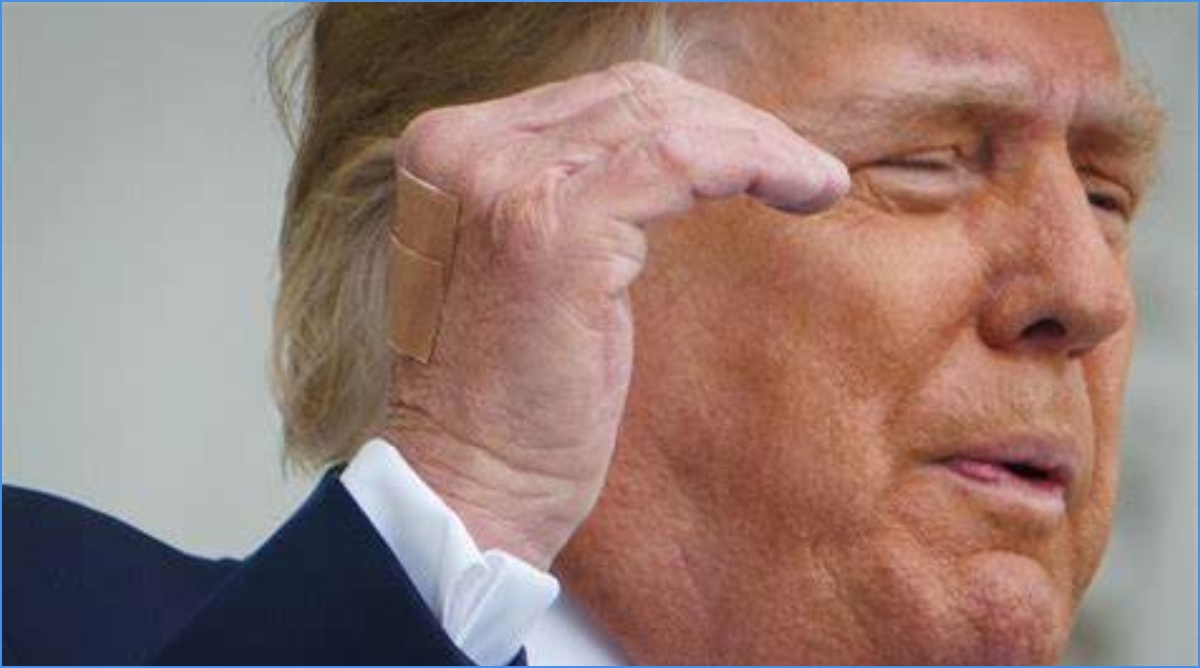 Photo of Trump wearing bandage: हमले के 48 घंटे बाद बने रिपब्लिकन उम्मीदवार; ‘वी लव ट्रम्प’ के लगे नारे