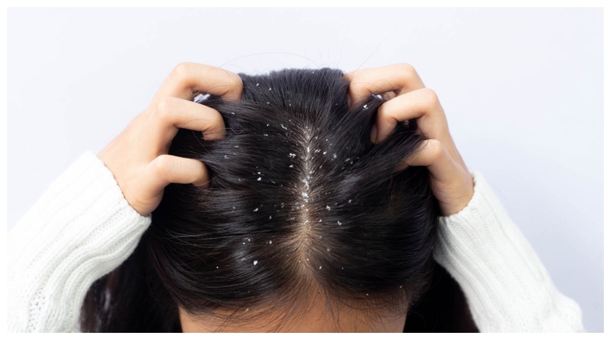 Photo of Hair Care Tips: दही में मिलाकर लगाएं ये 4 चीजें, डैंड्रफ से मिलेगा छुटकारा