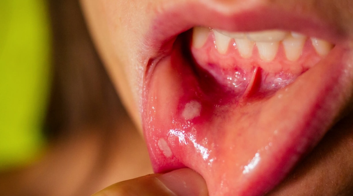 Oral health