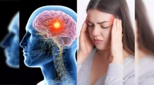 Brain cancer
