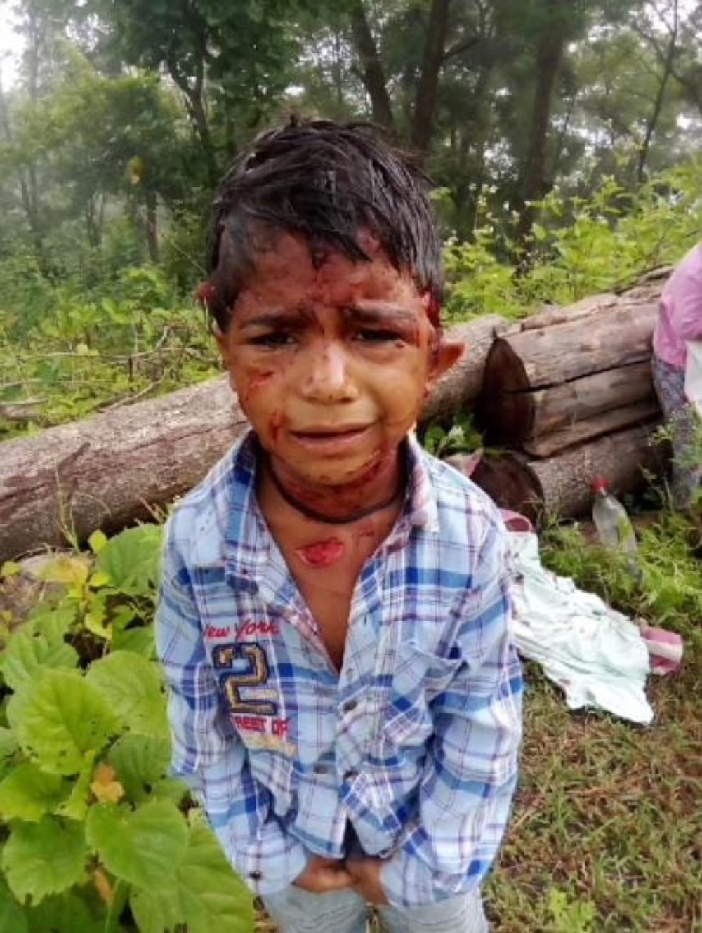 Photo of Leopard Attack : गुलदार ने 7 वर्षीय बच्चे पर किया हमला, हालत गंभीर