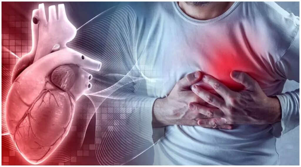 Heart Attack