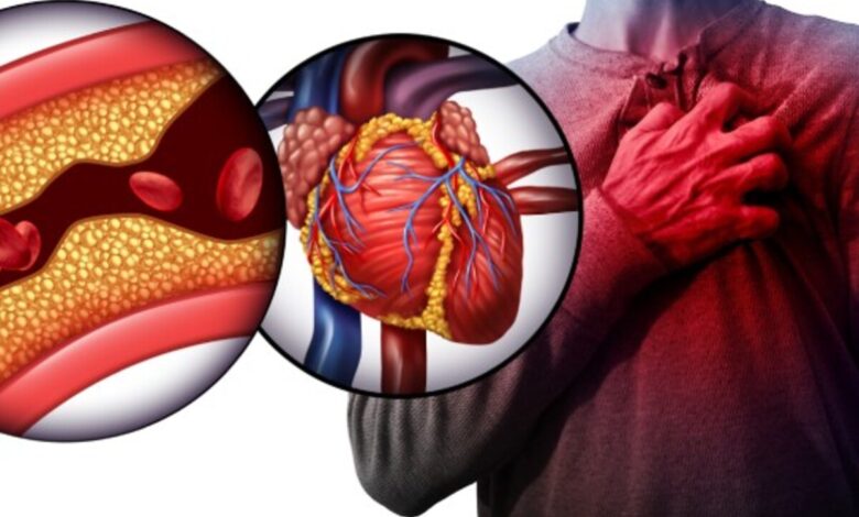 Heart Attack Prevention Tips