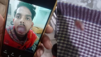 Photo of बीते साल हुई थी शादी, गाजियाबाद में पत्नी ने चाकू से काटी पति की जीभ