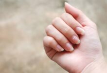 Photo of नाखूनों पर दिखने वाली धारियां क्या बताती हैं? जानिए सेहत के छुपे संकेत