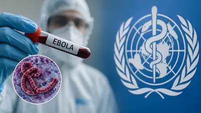 Ebola Virus
