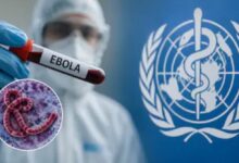 Photo of जयपुर एयरपोर्ट पर महिला यात्री में Ebola Virus के लक्षण, अस्पताल में भर्ती