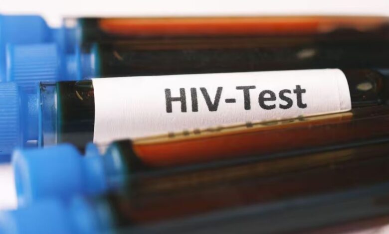 Karachi Hospital HIV Case